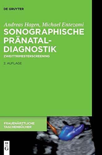 Sonographische Pränataldiagnostik: Zweittrimesterscreening (Frauenärztliche Taschenbücher) Sonographische Pränataldiagnostik: Zweittrimesterscreening (Frauenärztliche Taschenbücher)