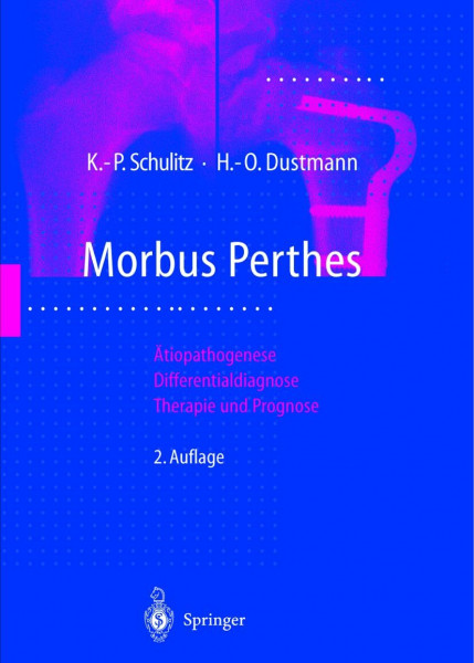 Morbus Perthes: Ätiopathogenese, Differentialdiagnose, Therapie und Prognose