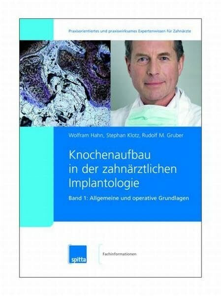Spitta GmbH Knochenaufbau In Der Zahnärztlichen Implantologie. 2007/2008. Band , Knochenaufbau In Der...