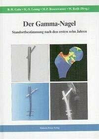 Der Gamma-Nagel: Standortbestimmung nach den ersten zehn Jahren
