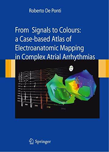 Riabilitazione: dall'inquadramento clinico al trattamento riabilitativo: Raccolta di articoli pubblicati sulla Testata registrata “Medici Oggi”: A ... Mapping in Complex Atrial arrhythmias