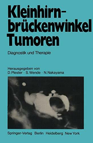 Kleinhirnbrückenwinkel-Tumoren: Diagnostik und Therapie
