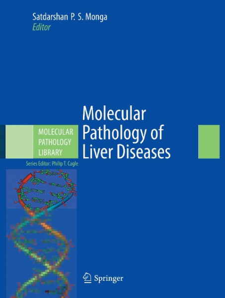 Molecular Pathology of Liver Diseases