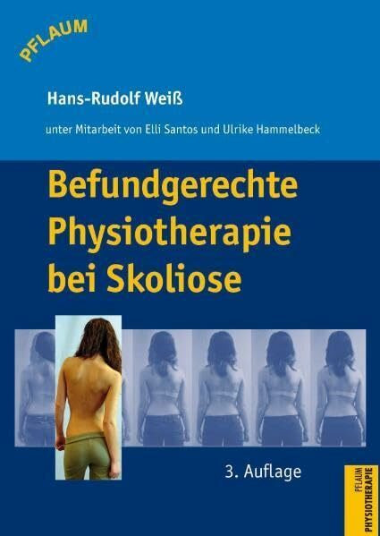 Befundgerechte Physiotherapie bei Skoliose