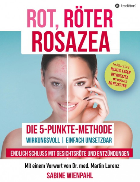 ROT RÖTER ROSAZEA