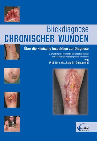 Blickdiagnose chronischer Wunden: Über die klinische Inspektion zur Diagnose