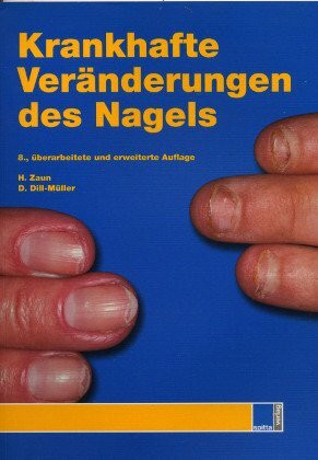 Krankhafte Veränderungen des Nagels