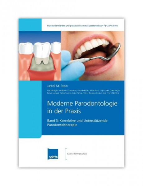 Moderne Parodontologie in der Praxis 03