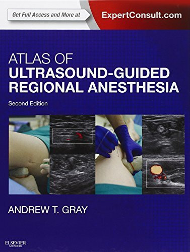 Atlas of Ultrasound-Guided Regional Anesthesia: Expert Consult.com. Enhanced Digital Version Included. Details inside