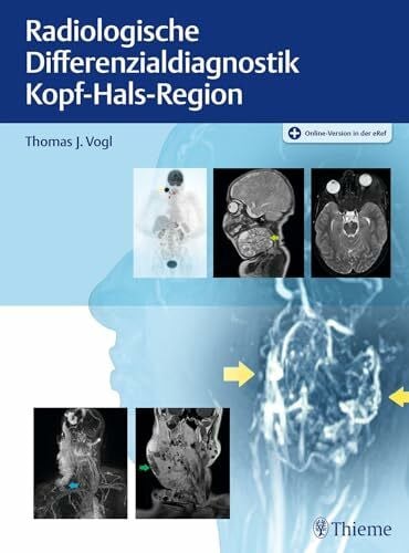 Radiologische Differenzialdiagnostik Kopf-Hals-Region