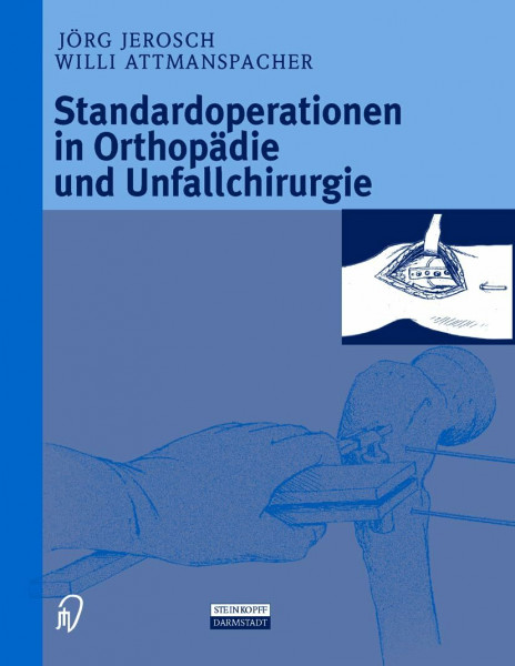 Standardoperationen in Orthopädie und Unfallchirurgie