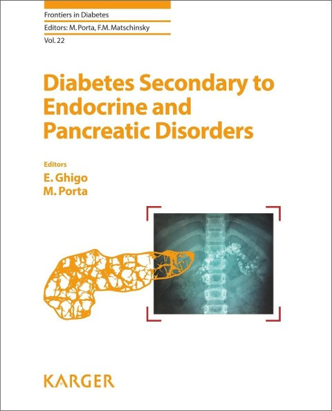 Diabetes Secondary to Endocrine and Pancreatic Disorders