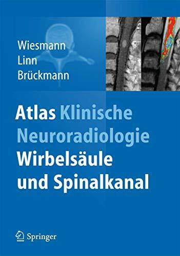 Atlas Klinische Neuroradiologie: Wirbelsäule und Spinalkanal Atlas Klinische Neuroradiologie: Wirbelsäule und Spinalkanal