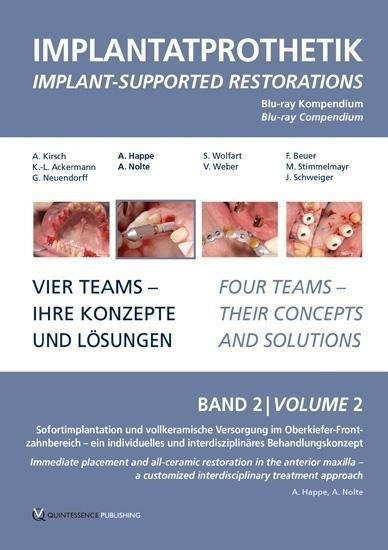 DVD-Kompendium Implantatprothetik 2