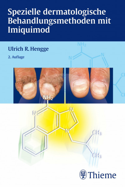 Spezielle dermatologische Behandlungsoptionen mit Imiquimod