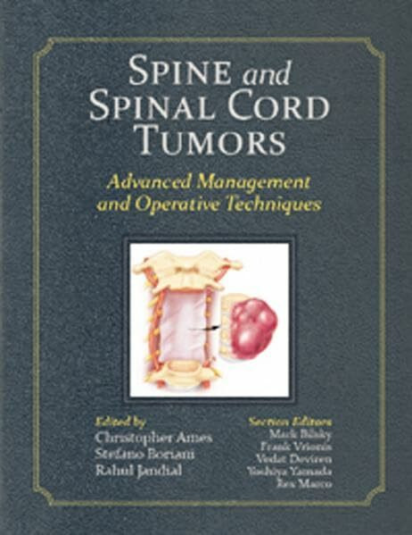 Spine and Spinal Cord Tumors: Advanced Management and Operative Techniques