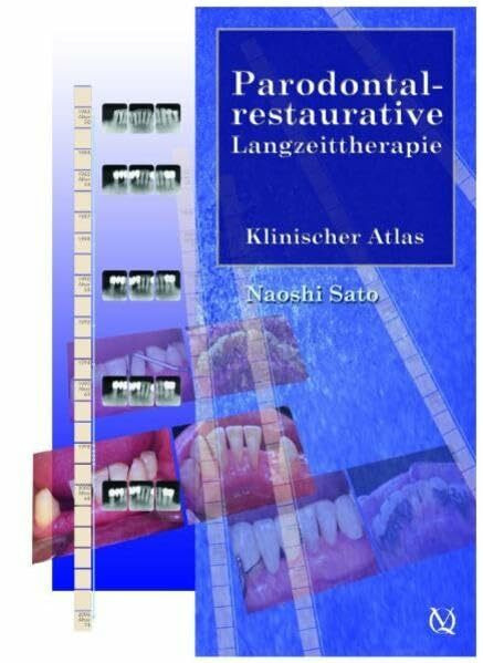 Parodontal-restaurative Langzeittherapie: Klinischer Atlas