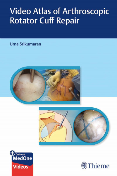 Video Atlas of Arthroscopic Rotator Cuff Repair: Including online access