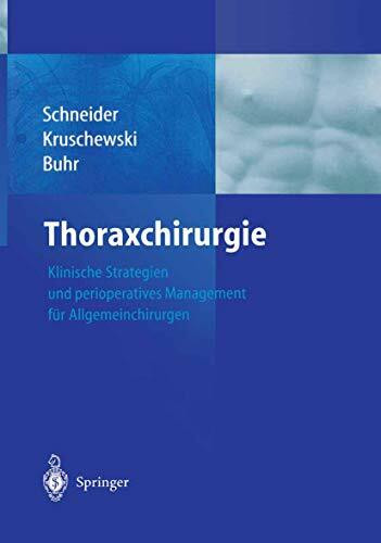 Thoraxchirurgie: Klinische Strategien und perioperatives Management für Allgemeinchirurgen