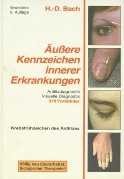 Antlitzdiagnostik: Äußere Kennzeichen innerer Erkrankungen, Bd. 1: Lehrbuch und Farbatlas für Pathophysiognomie und visuelle Diagnostik