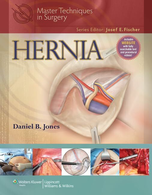 Hernia (Master Techniques in Surgery) Hernia (Master Techniques in Surgery)