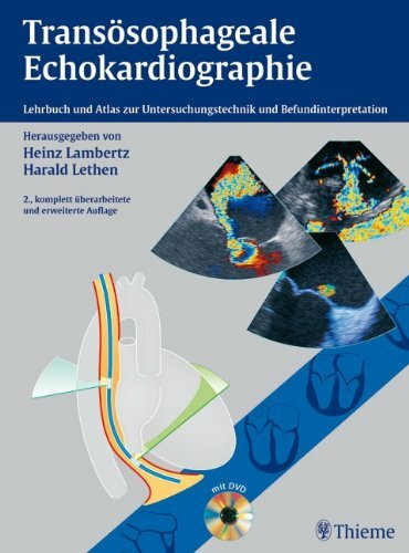 Transösophageale Echokardiographie: Lehrbuch und Atlas zur Untersuchungstechnik und Befundinterpretation