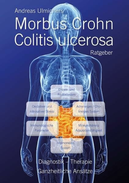 Andreas Ulmichers Morbus Crohn – Colitis ulcerosa Ratgeber: Diagnostik, Therapie - Ganzheitliche Ansätze