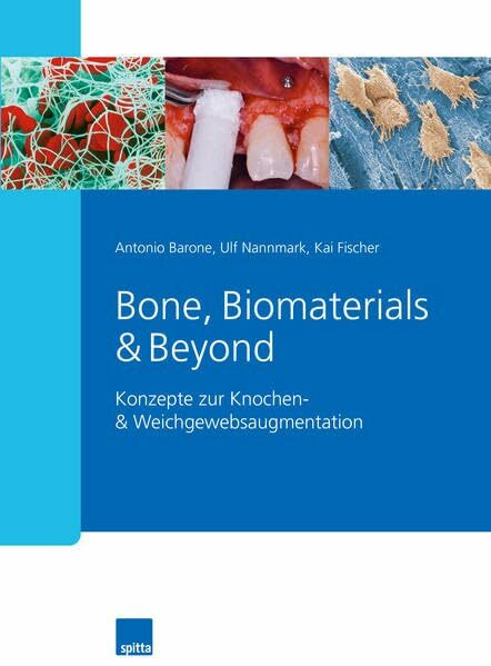 Bone, Biomaterials & Beyond: Konzepte zur Knochen- & Weichgewebsaugmentation
