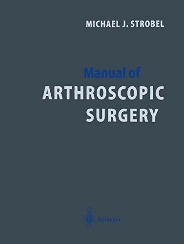 Manual of Arthroscopic Surgery