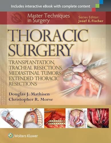 Thoracic Surgery: Transplantation, Tracheal Resections, Mediastinal Tumors, Extended Thoracic Resections (Master Techniques in Surgery)