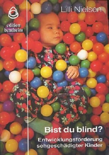 Bist du blind?: Entwicklungsförderung sehgeschädigter Kinder