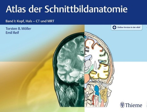 Atlas der Schnittbildanatomie. Band 01