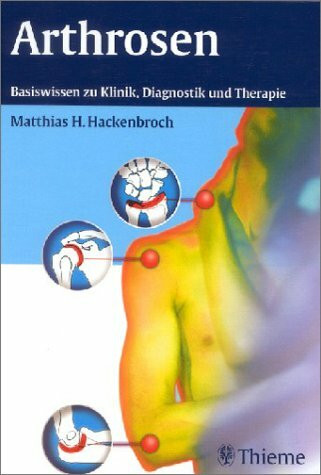 Arthrosen. Basiswissen zu Klinik, Diagnosen und Therapie