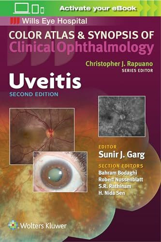 Uveitis (Color Atlas & Synopsis of Clinical Ophthalmology)