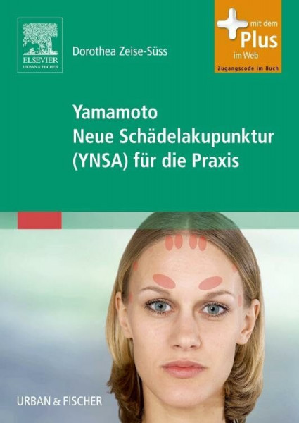 Yamamoto Neue Schädelakupunktur (YNSA) für die Praxis: mit Zugang zum Elsevier-Portal