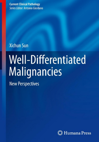 Well-Differentiated Malignancies