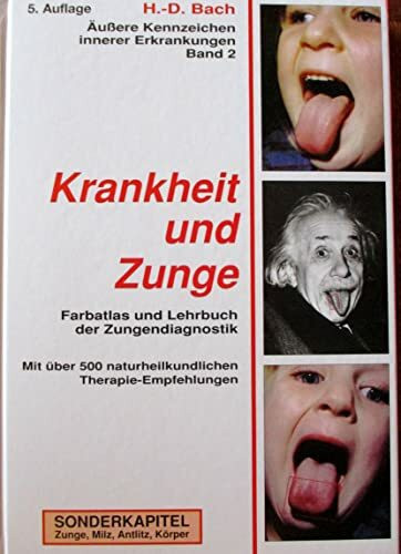 Antlitzdiagnostik: Äußere Kennzeichen innerer Erkrankungen, Bd.2, Krankheit und Zunge: Farbatlas und Lehrbuch der Zungendiagnostik. Sonderkapitel: Zunge, Milz, Antlitz, Körper