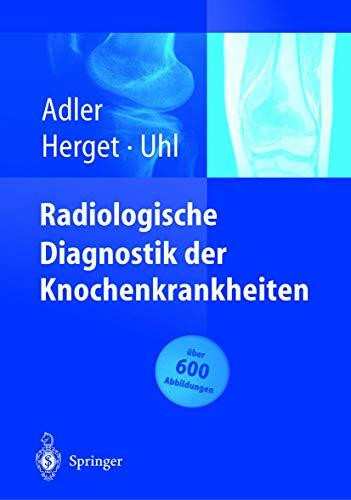 Radiologische Diagnostik der Knochenkrankheiten