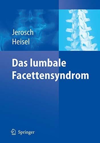 Das lumbale Facettensyndrom