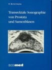 Transrektale Sonographie von Prostata und Samenblasen