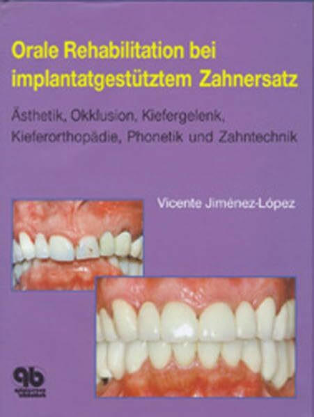 Orale Rehabilitation bei implantatgestütztem Zahnersatz: Ästhetik, Okklusion, Kiefergelenk, Kieferorthopädie, Phonetik und Zahntechnik