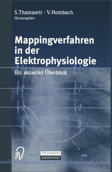 Mappingverfahren in der Elektrophysiologie. Ein aktueller Überblick