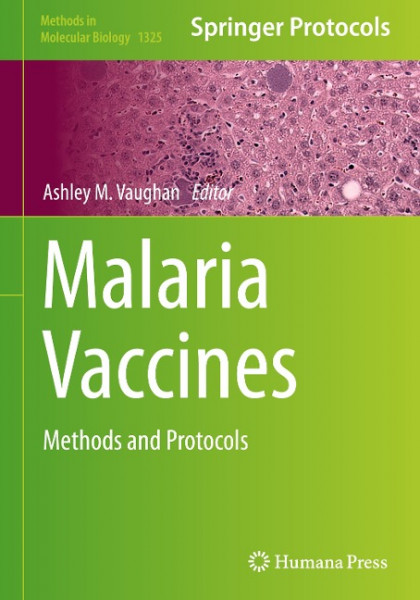Malaria Vaccines