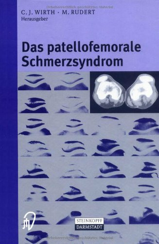 Das patellofemorale Schmerzsyndrom