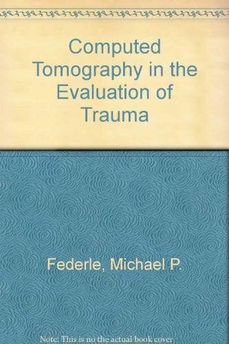 Computed Tomography in the Evaluation of Trauma Computed Tomography in the Evaluation of Trauma