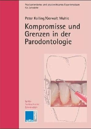Kompromisse und Grenzen in der Parodontologie