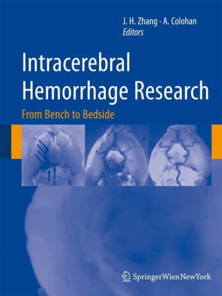 Intracerebral Hemorrhage Research