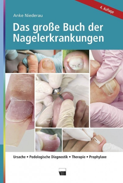 Das große Buch der Nagelerkrankungen