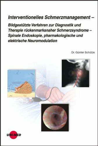 Interventionelles Schmerzmanagement