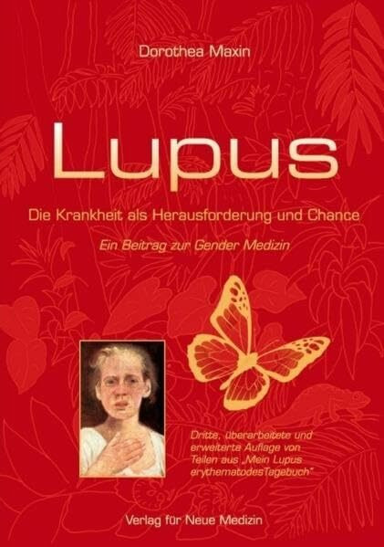 Lupus: Die Krankheit als Herausforderung und Chance. Ein Beitrag zur Gender Medizin